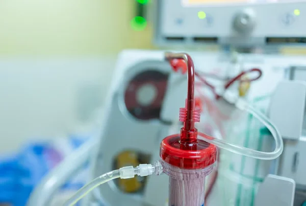 Hemodialysis